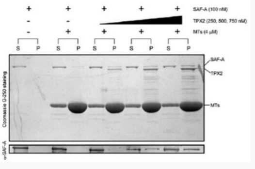 Coomassie blue staining of purified TPX2 protein (TPX2-222HFL).jpg